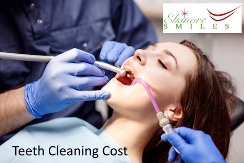 Teeth Cleaning Cost in Canyon Lake